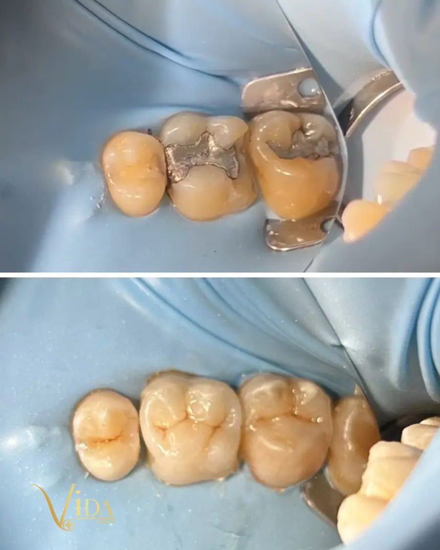 Sorrisos transformados que passaram por nossas mãos - imagem 18