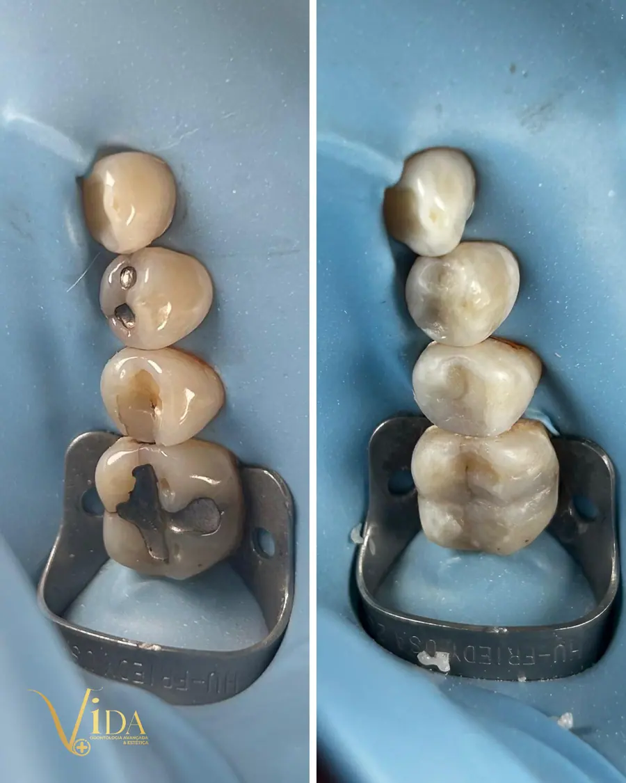 Sorrisos transformados que passaram por nossas mãos - imagem 19