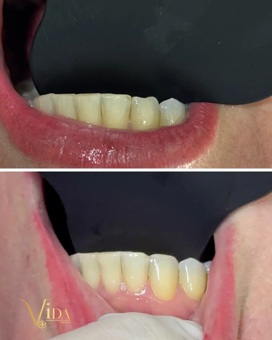 Sorrisos transformados que passaram por nossas mãos - imagem 22