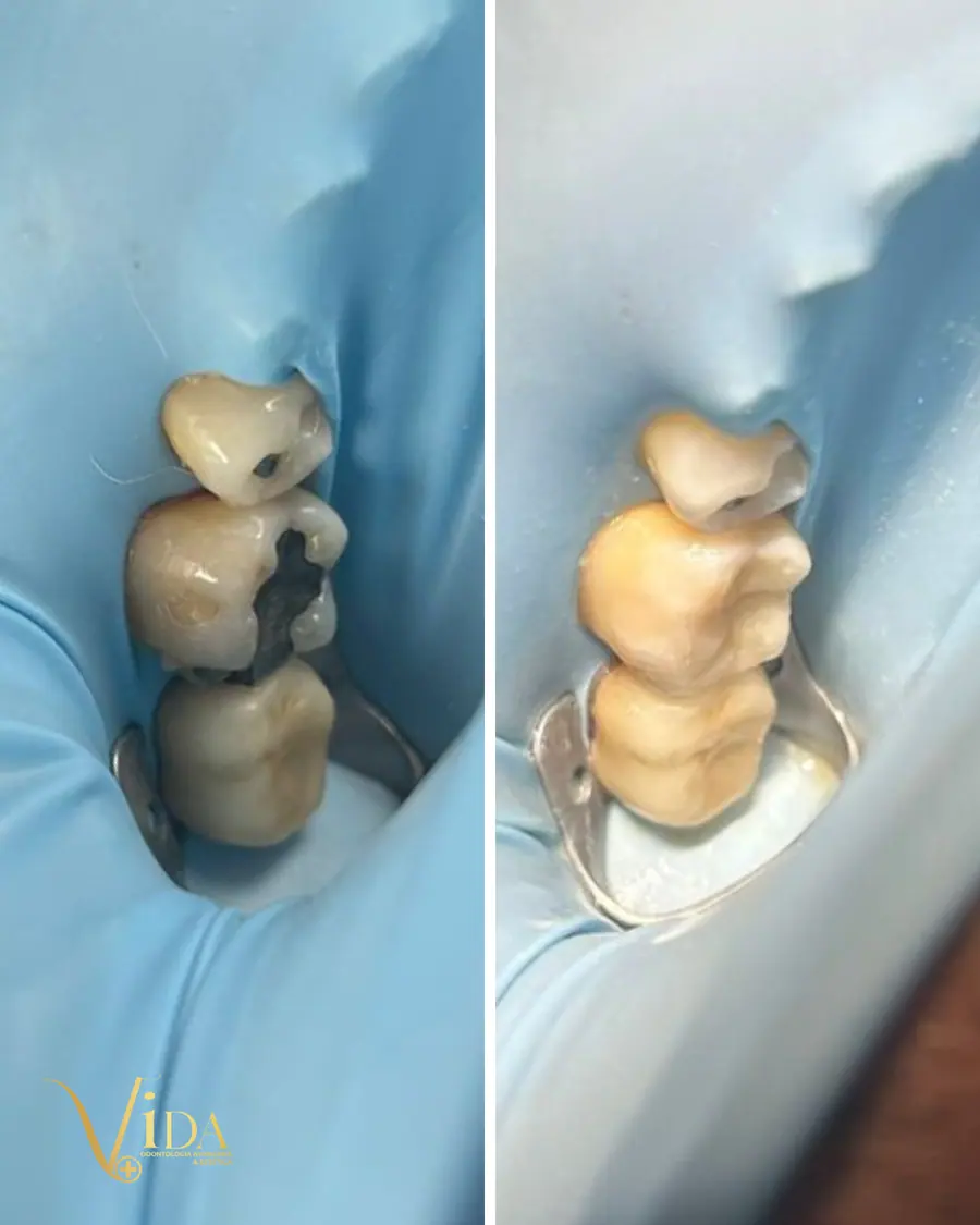 Sorrisos transformados que passaram por nossas mãos - imagem 23